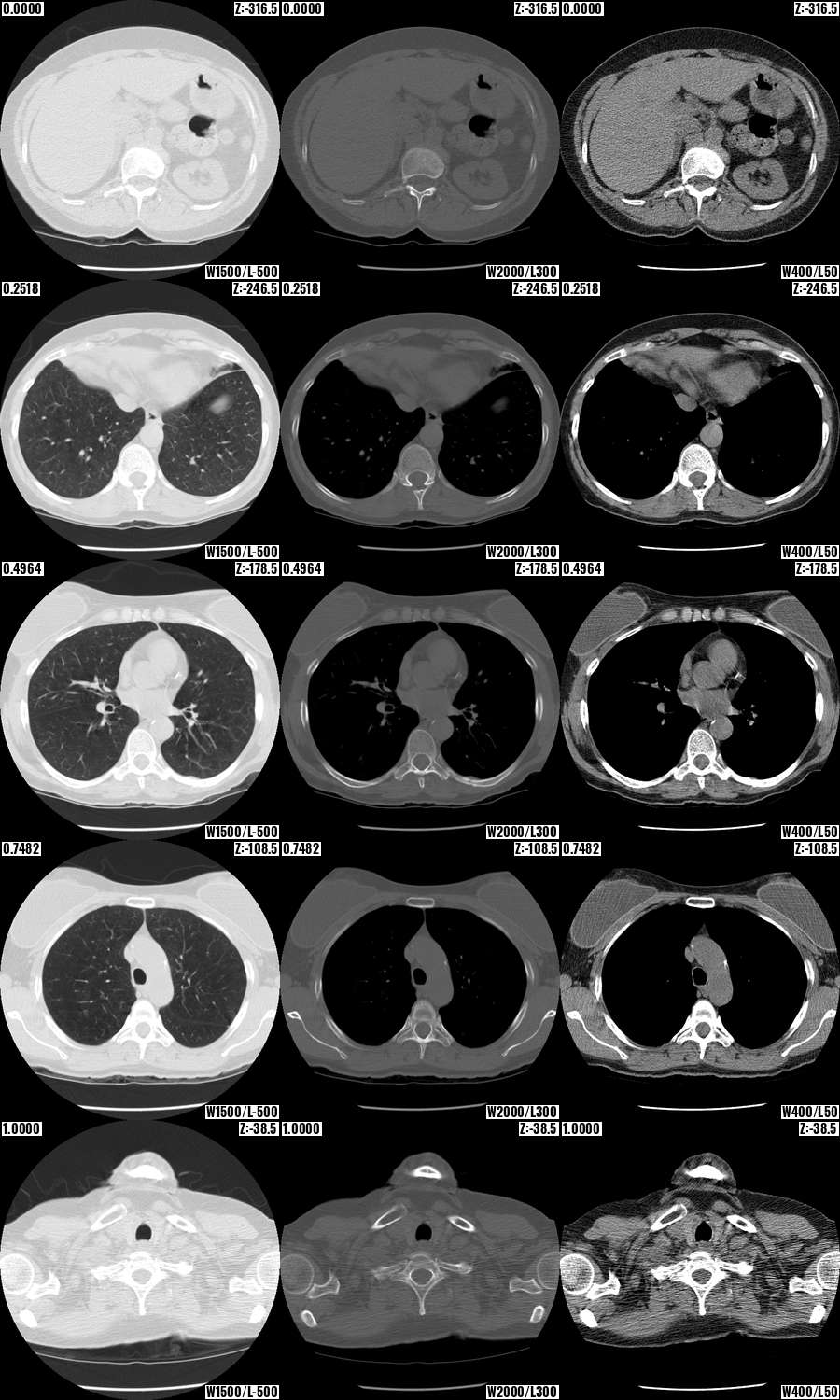 Contrast mosaic